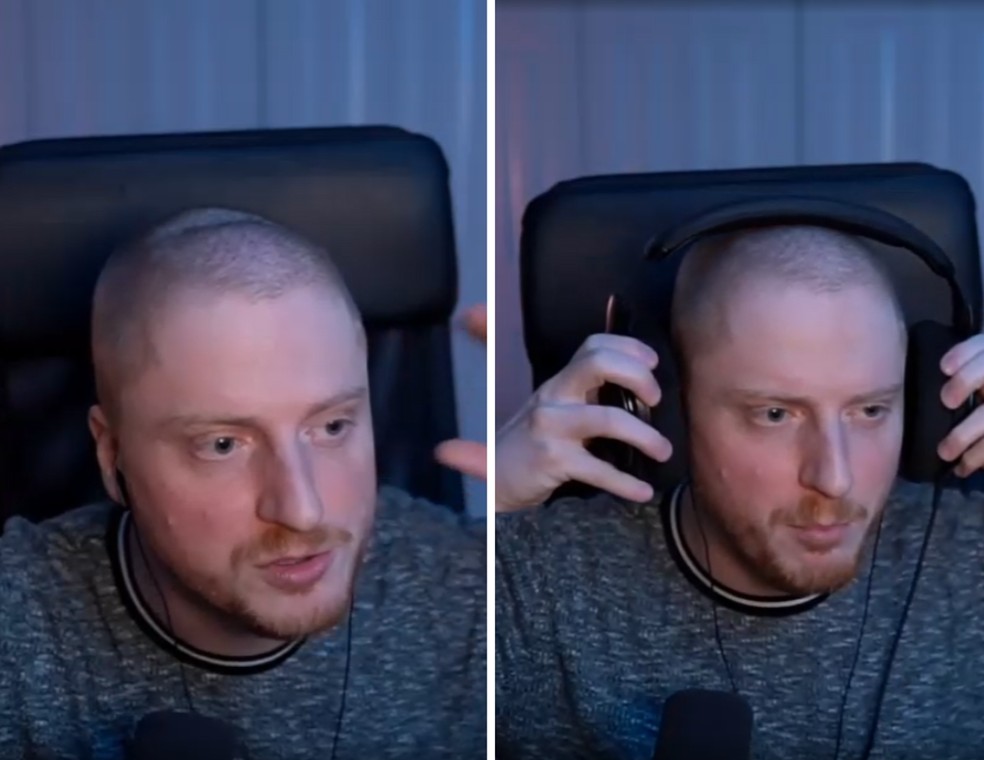 Streamer viraliza ao raspar cabelo e descobrir cabeça deformada por uso  prolongado de headphone: 'Como assim?!', Notícias