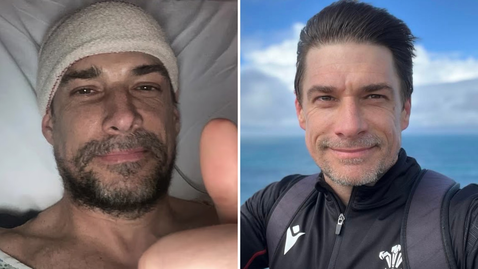 Ator revela sintomas que o fizeram descobrir tumor enorme e quase fatal ...