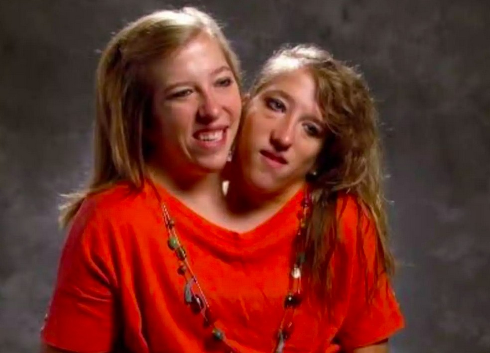 A estrelas de reality show Abby e Brittany Hensel — Foto: Reprodução