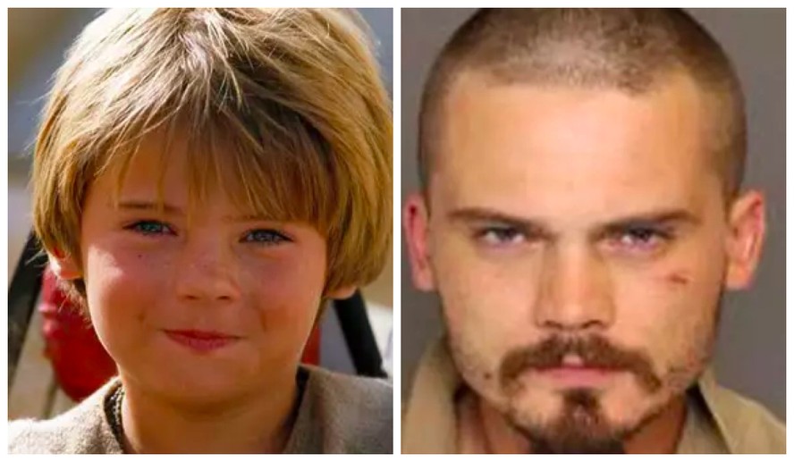 Jake Lloyd Antes E Agora Jake Lloyd, Que Interpretou Anakin Ainda