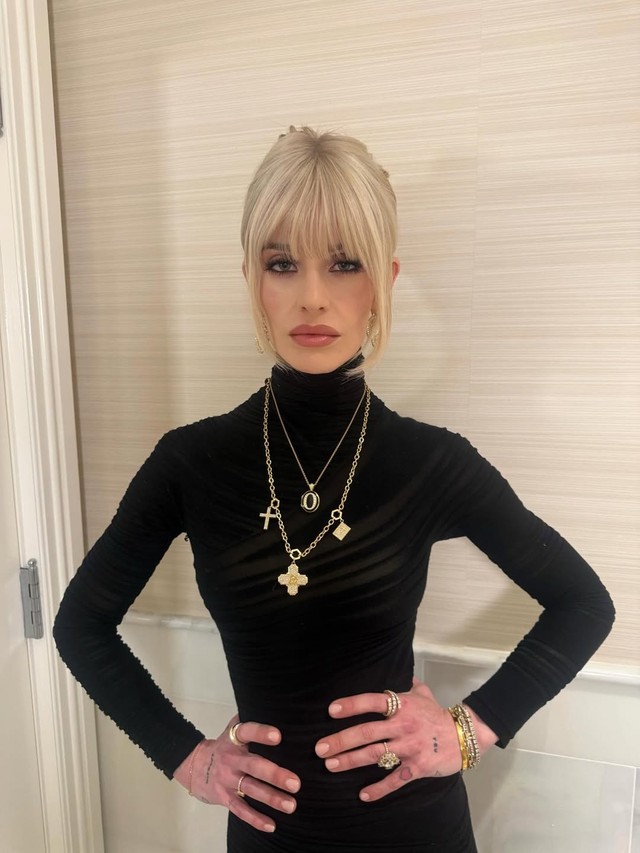 Kelly Osbourne rebate ataques 'cruéis' à sua aparência após receber ...