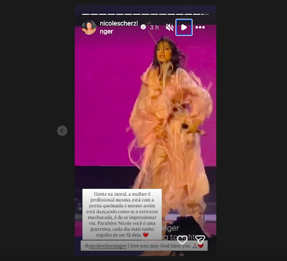 Cantora Nicole Scherzinger mostra bolhas e queimaduras após derramar ...