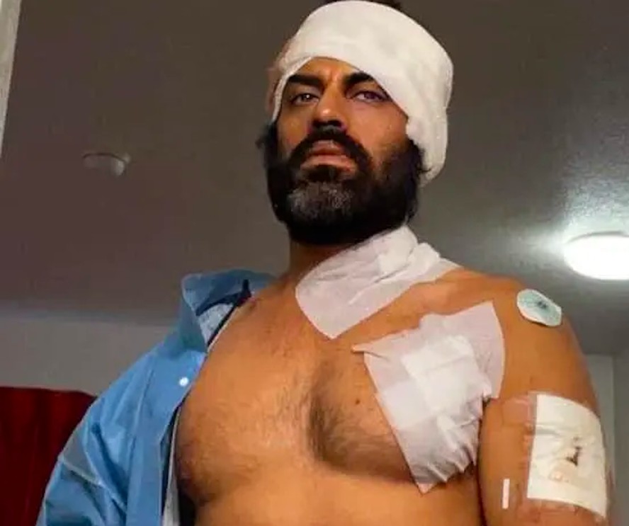 O ator bollywoodiano Aman Dhaliwal com curativos cobrindo as lesões decorrentes do ataque que sofreu em uma academia na Califórnia