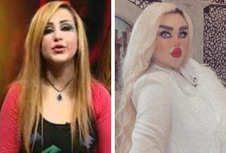 O antes e depois de Dalia Naeem