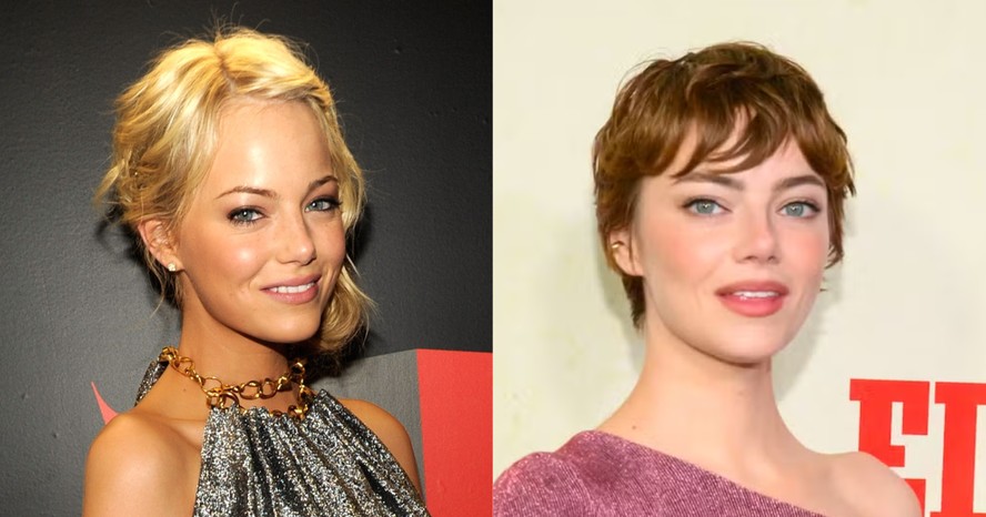 Emma Stone revela procedimento estético culpado por seu maior ...