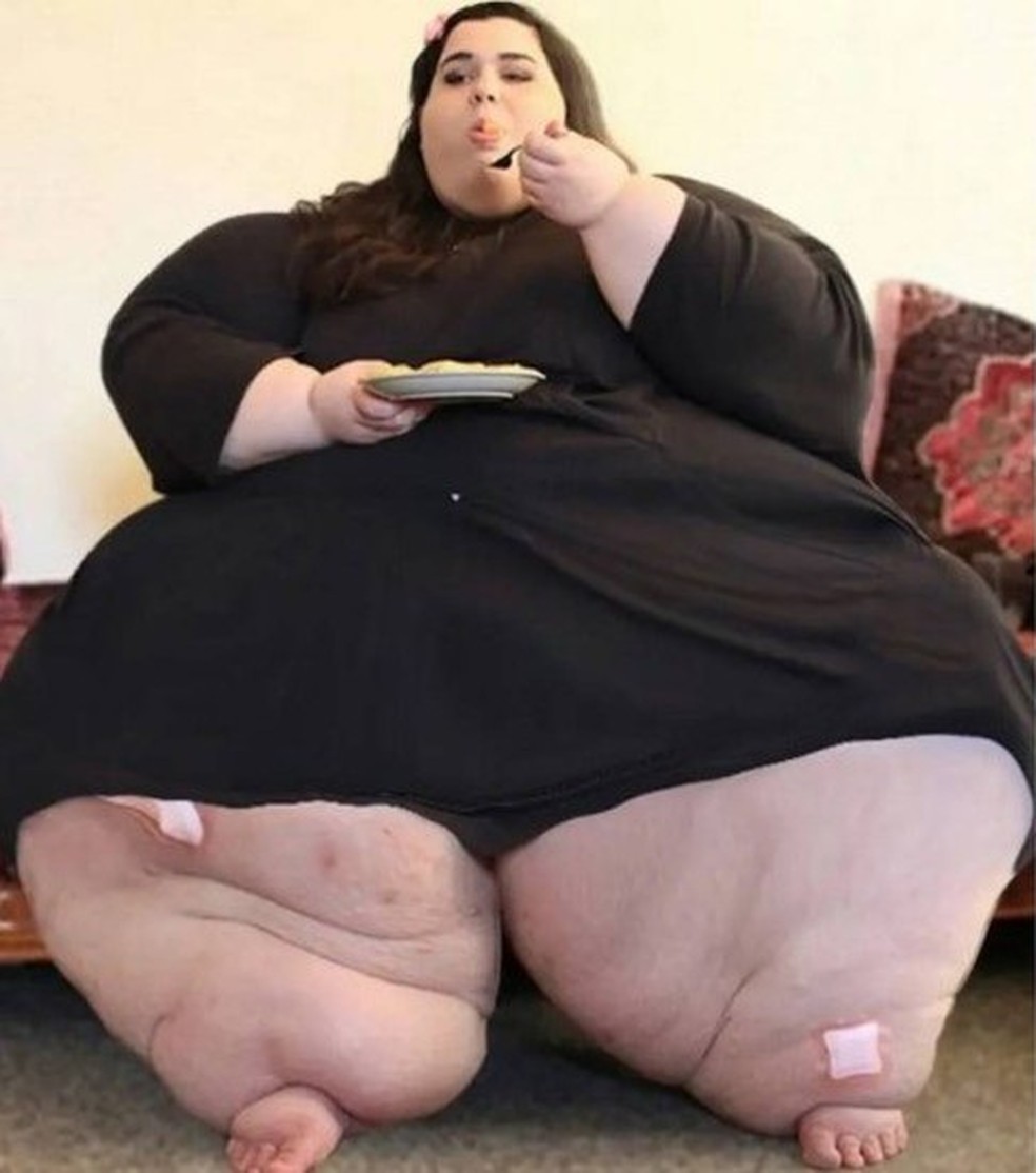 Amber Rachdi com quase 300 kg — Foto: Reprodução/TLC