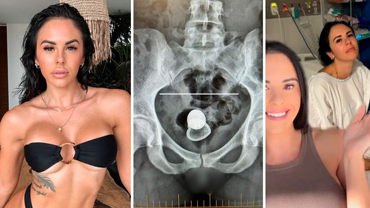 Ex-carcereira que virou atriz pornô revela 'acidente sexual' bizarro que a levou para mesa de cirurgia