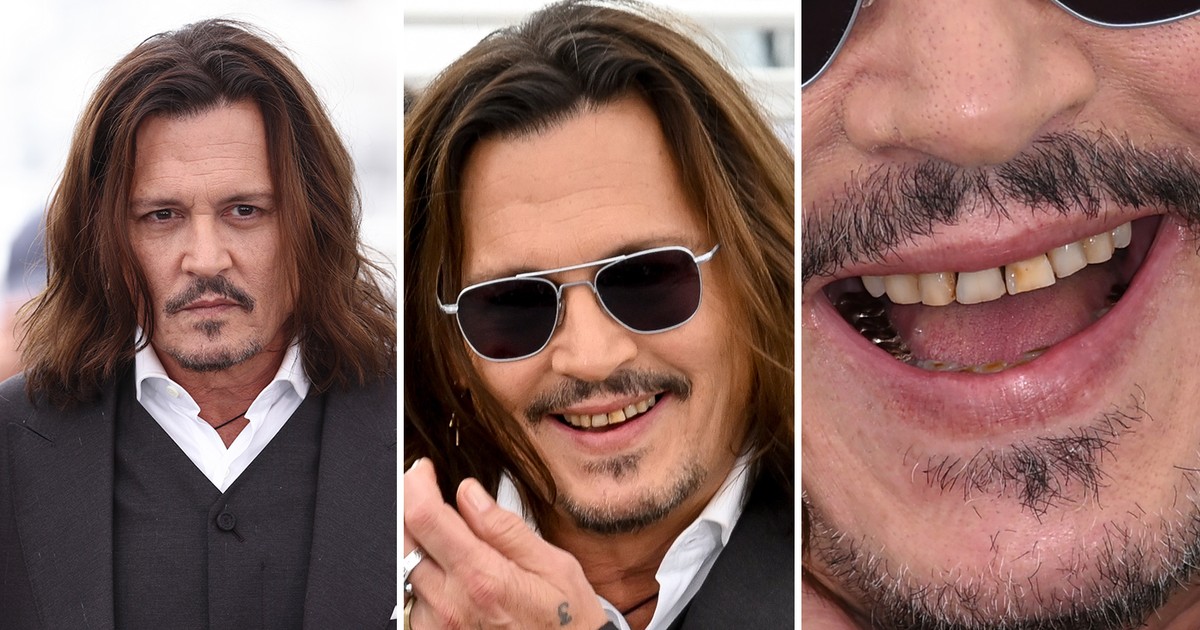 Los fanáticos se sorprendieron por los dientes ‘podridos’ de Johnny Depp en Cannes: ‘Arruinaron mi día’ |  famosos