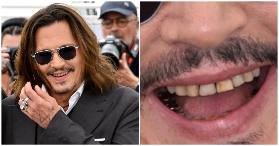 Johnny Depp em Cannes e seus dentes