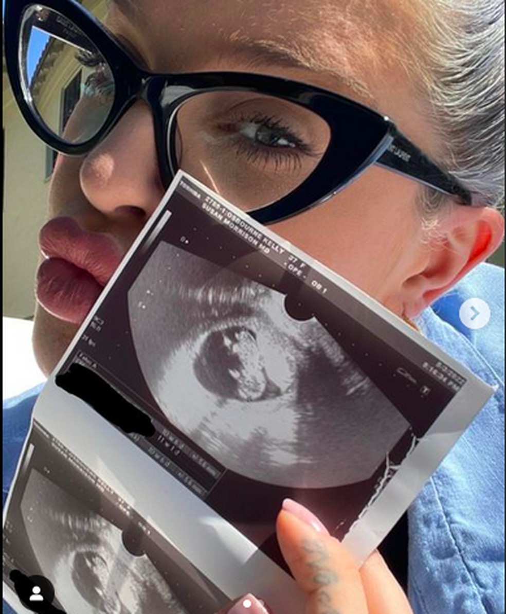 Kelly Osbourne foi extremamente discreta nas redes sociais durante a gestação de seu primeiro filho, só expondo uma única foto referente à sua gravidez, ao mostrar a primeira ultrassonografia do bebê — Foto: Instagram