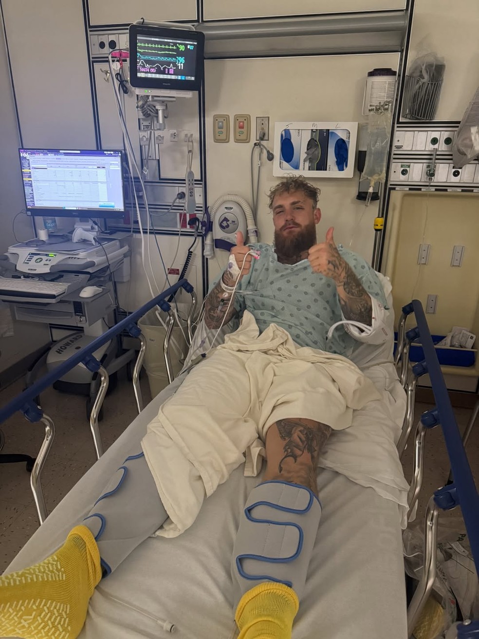 Jake Paul precisou passar por cirurgia após luta contra Anthony Joshua — Foto: reprodução/Instagram