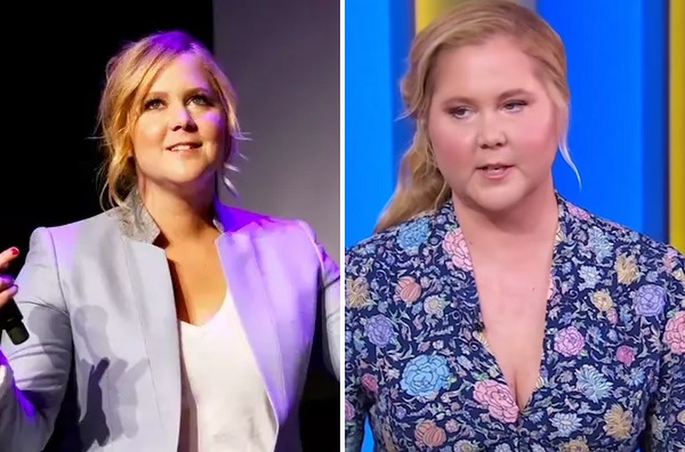 O rosto da atriz Amy Schumer em aparições recentes (foto da direita) chamou atenção dos fãs pelo inchaço em seu rosto — Foto: Getty Images/Reprodução
