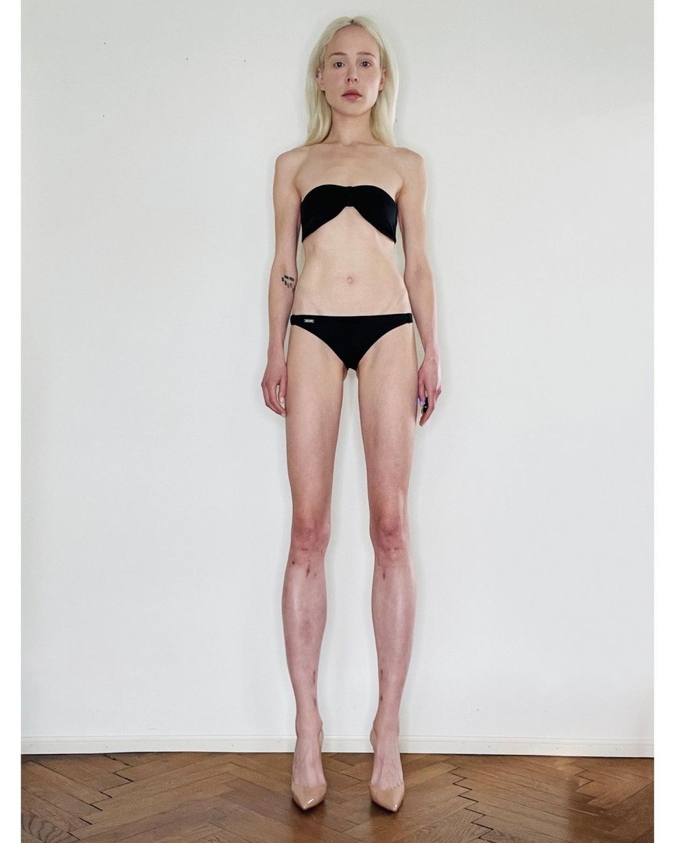 A modelo alemã Theresia Fischer — Foto: Reprodução/Instagram