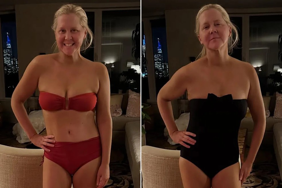 Amy Schumer exibe perda de 23 quilos nas redes — Foto: reprodução/Instagram