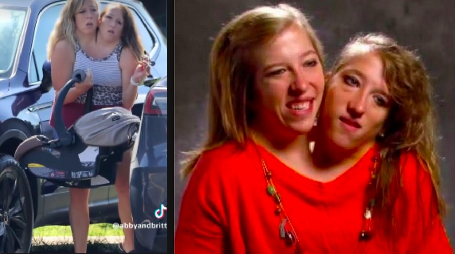 Gemeas Siamesas Abby E Brittany Hensel