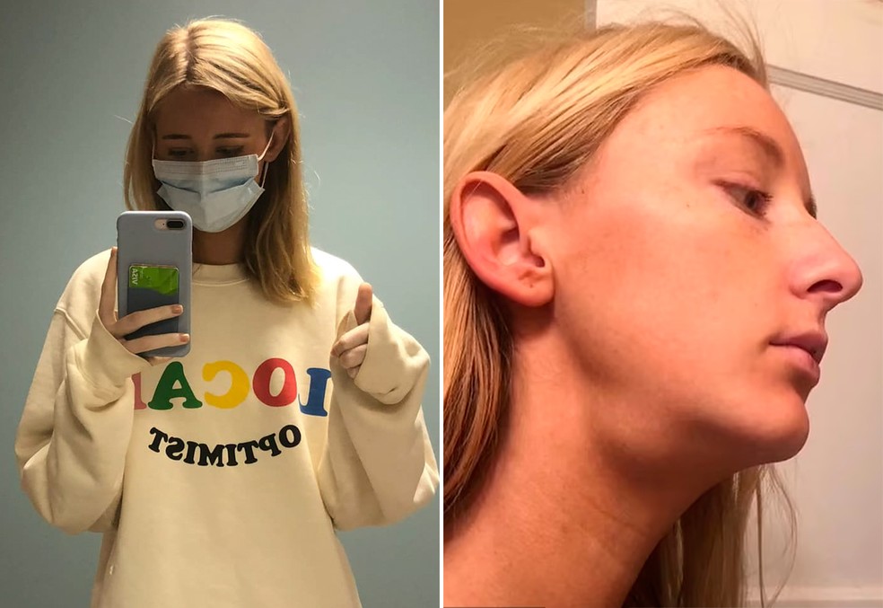 Helen Bender descobriu um tumor agressivo com a ajuda de um tutorial de beleza no TikTok — Foto: reprodução/facebook e tiktok
