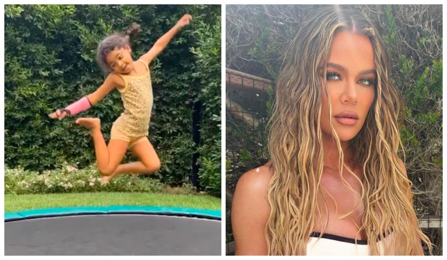 Khloé Kardashian publicou vídeo da filha pulando em trampolim com o braço lesionado
