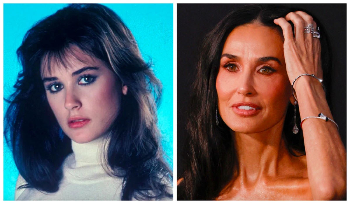 Demi Moore não vai mais cair em cilada das cirurgias plásticas após gastar 1,7 milhão de reais em procedimentos, diz revista: 'Fugiu do controle'