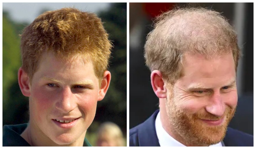 O Príncipe Harry em fotos de 2005 e 2023