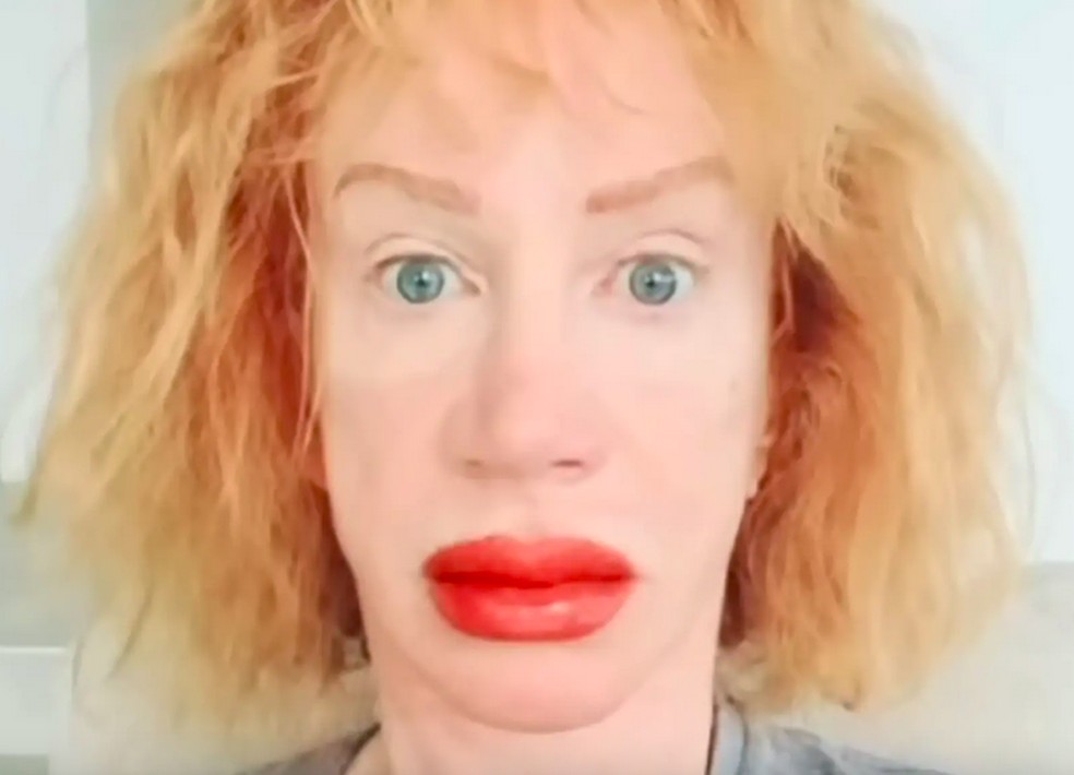 A comediante Kathy Griffin após procedimento nos lábios — Foto: YouTube