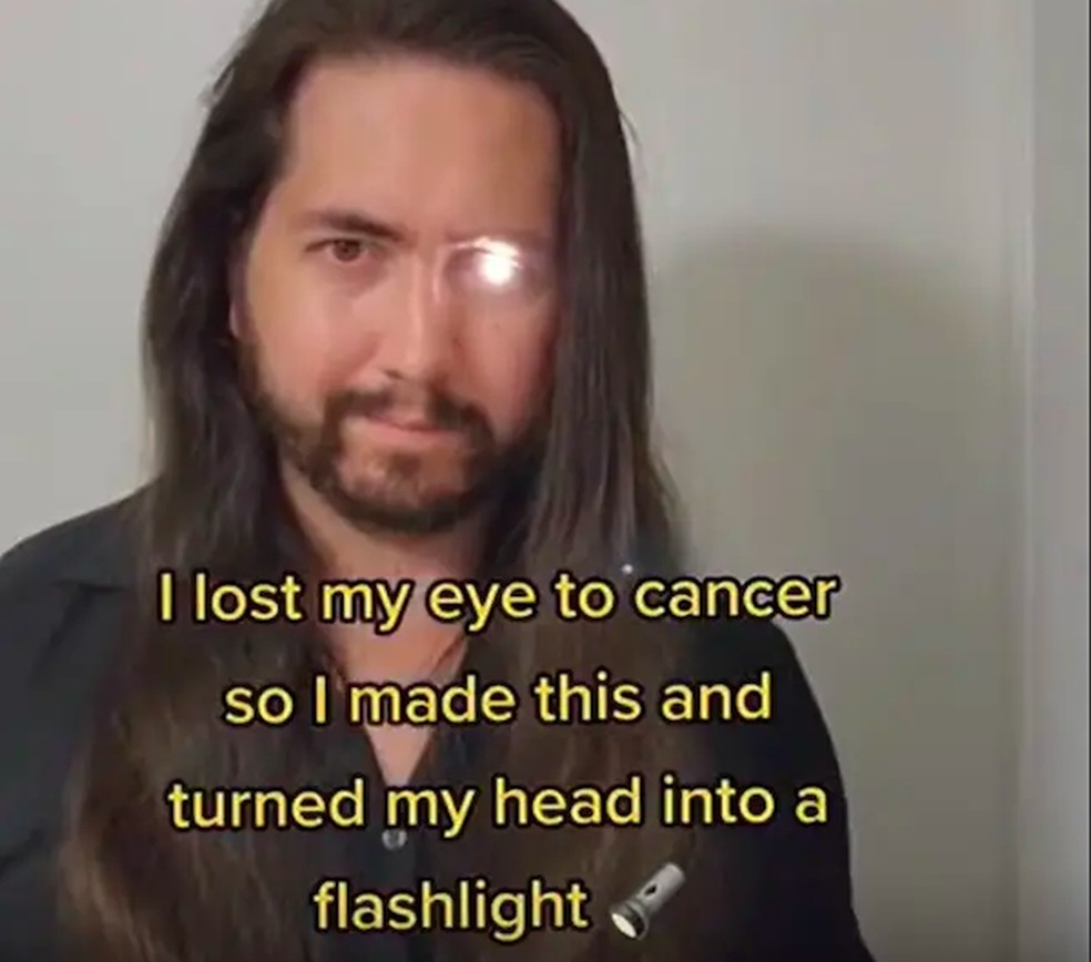 O indivíduo com uma lanterna no lugar do olho que perdeu para um câncer — Foto: Reddit