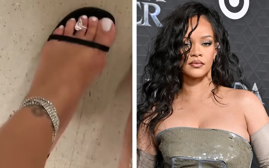 Rihanna deixa fãs de queixo caído ao usar anel de diamante em dedo do pé