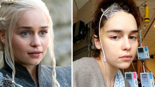 Emilia Clarke revela medo de ser demitida de 'Game of Thrones' após duas hemorragias cerebrais